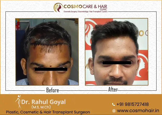 Cosmo Care & Hair Clinic