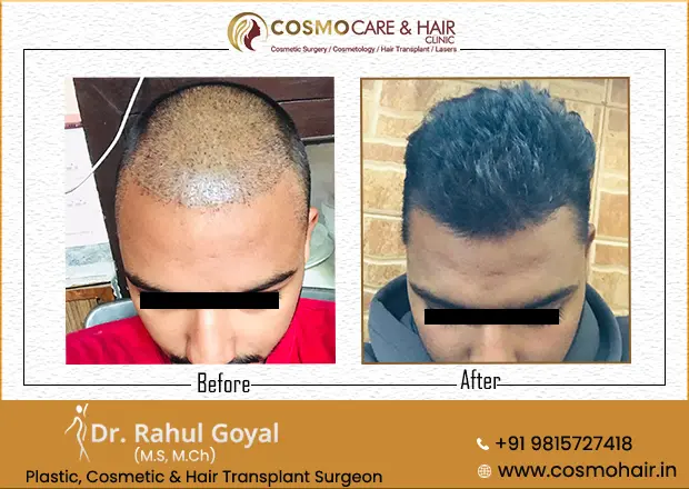 Cosmo Care & Hair Clinic