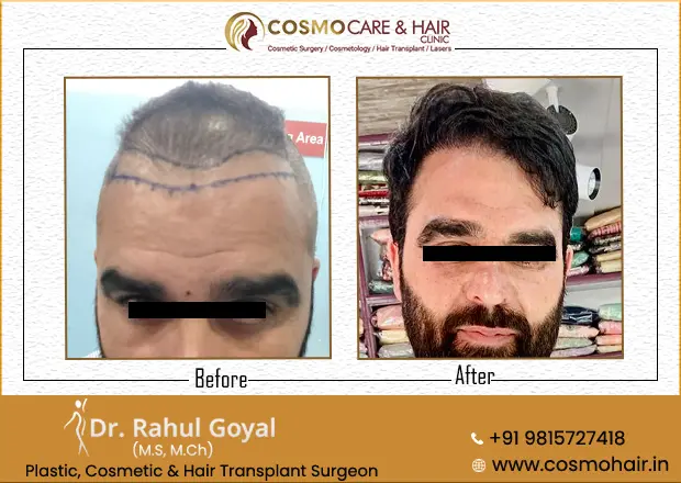 Cosmo Care & Hair Clinic