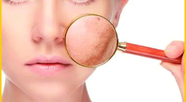 Dr. Dermat Advanced Hair Treatment