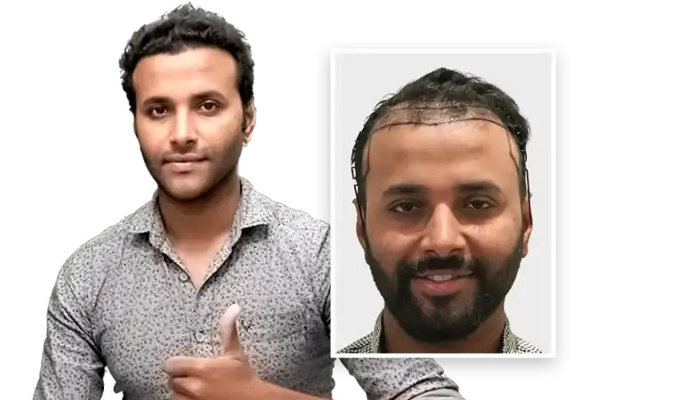 Hair Free and Hair Grow