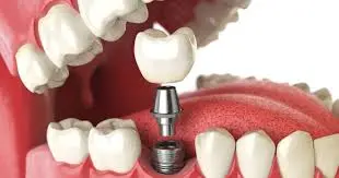 Arch Dental Care