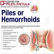 Centre for Piles and Fistula