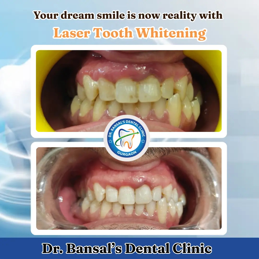 Dr Bansal's Dental and Implant Clinic
