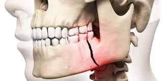 Smile On Dental & Facial Trauma Care
