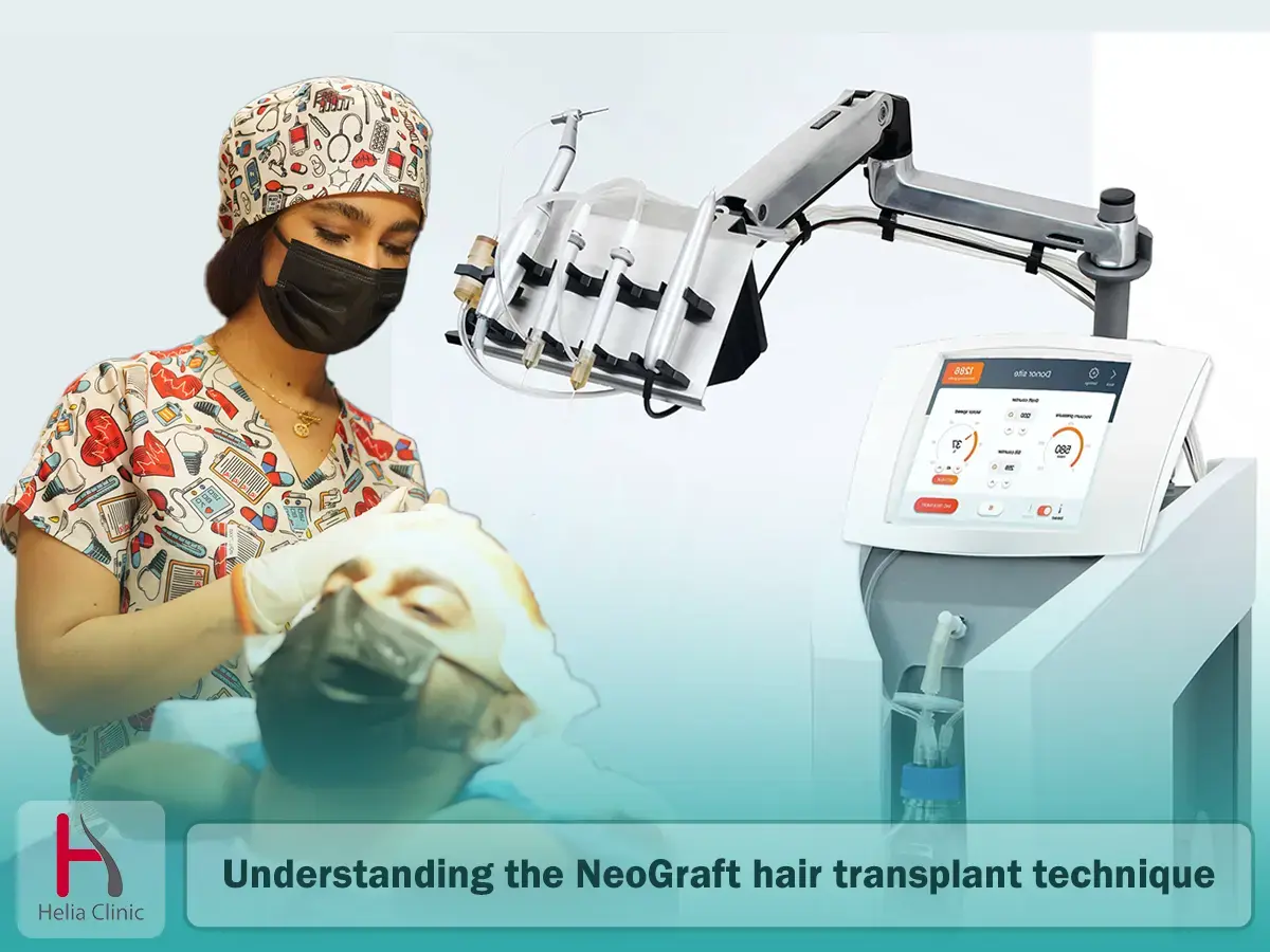 NeoGraft Clinic